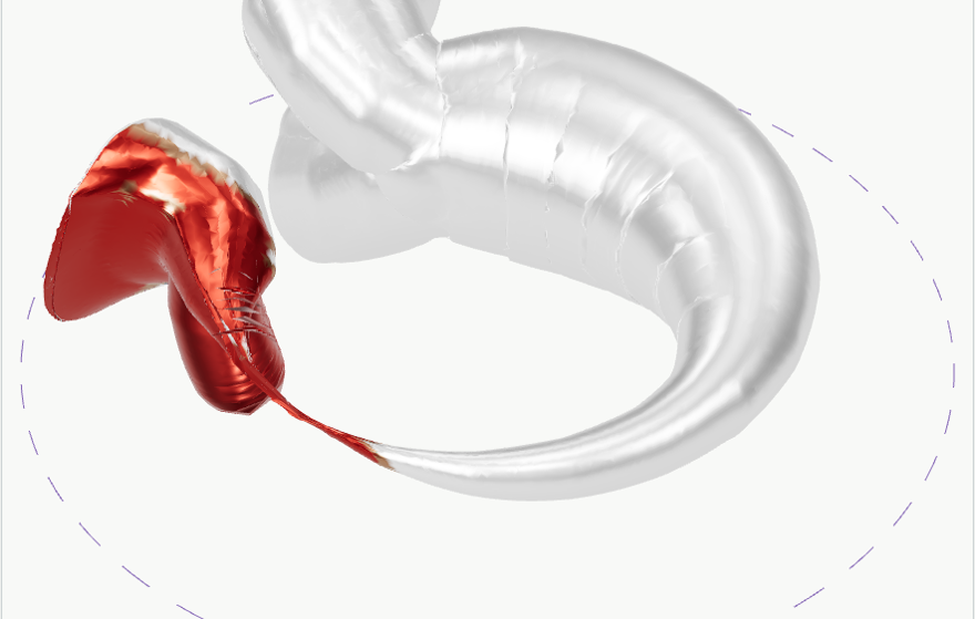 Roots ring pushed along its surface normal, failing areas in red